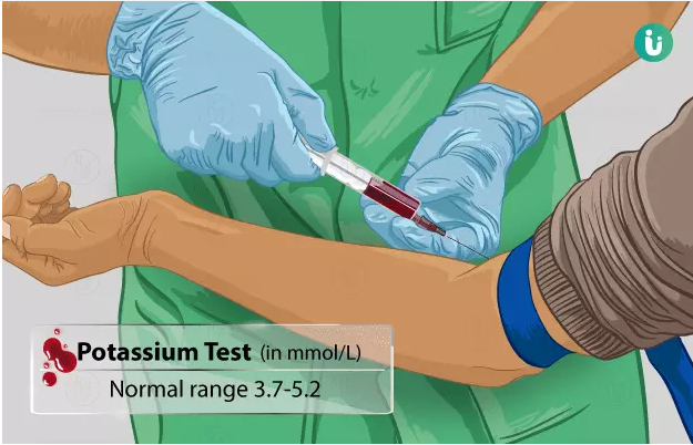 همه چیز در مورد آزمایش پتاسیم (Potassium Test Quick Guide)